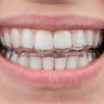 Alinhador Invisível