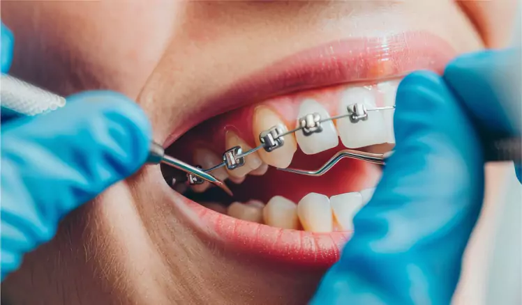 Por que escolher a Ortho+?
