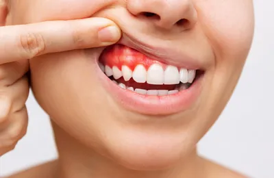 Periodontia